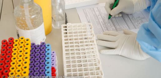 Opinion: Epidemic preparedness is the building block for pandemic response