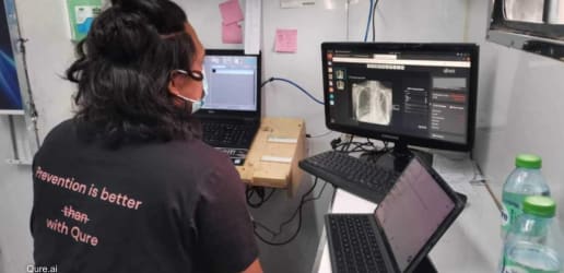 Opinion: How AI can rejuvenate imaging equipment to ramp up TB screening