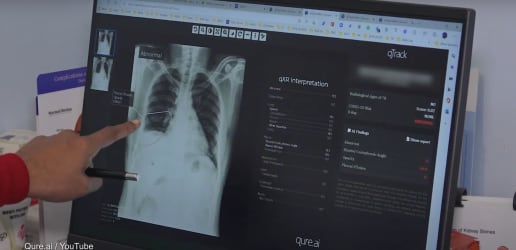 How AI is transforming medical diagnosis in India’s tribal regions