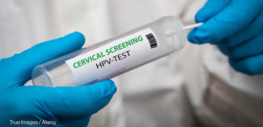 Africa has bold cervical cancer plans. Now we must deliver them