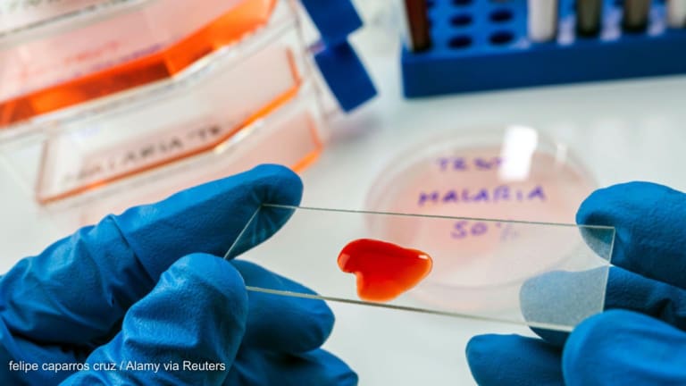 Research suggests malaria exposure could reduce COVID-19 severity 