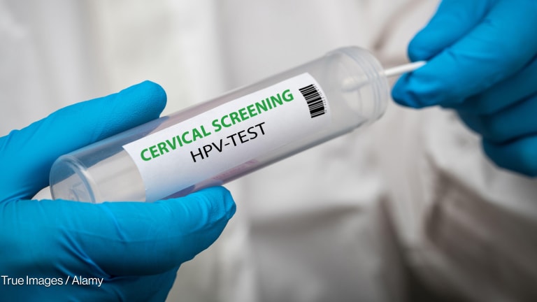Related Stories - Africa has bold cervical cancer plans. Now we must deliver them
