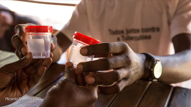 Related Stories - WHO backs pooled TB testing to expand diagnosis and cut costs