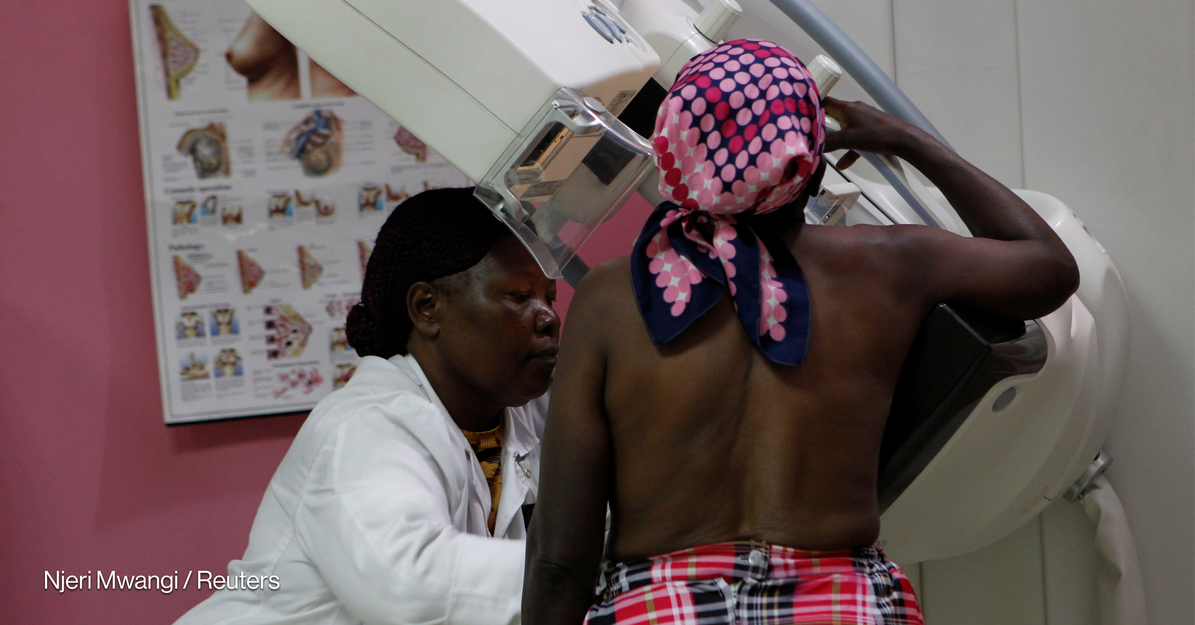 New index aims to help countries close breast cancer care gaps