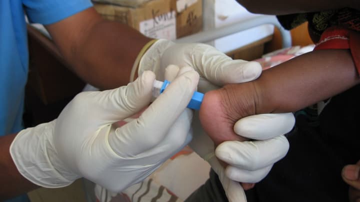 Q&A Cutting testing wait times to get more infants on HIV