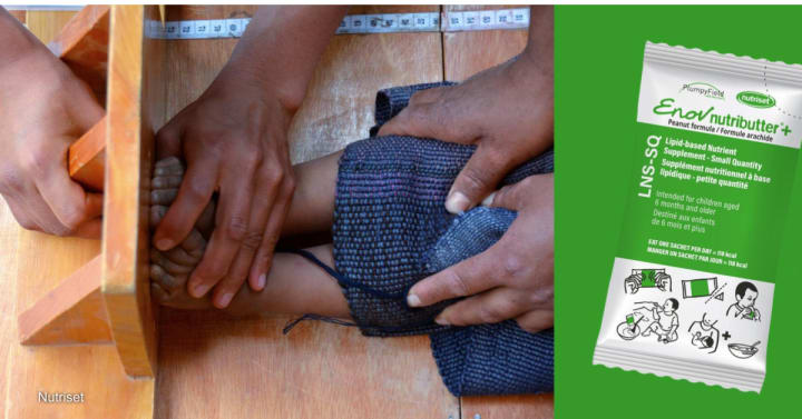 Nutrition experts call for child malnutrition supplement scale-up