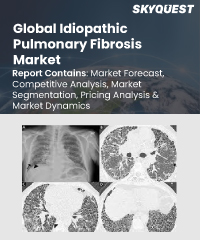 Global Idiopathic Pulmonary Fibrosis Market