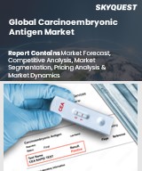 Middle East & Africa Dry Eye Syndrome Market