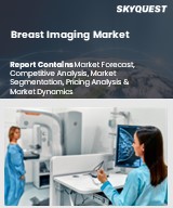 Breast Imaging Market