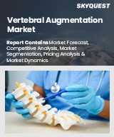 Global Vertebral Augmentation Market