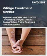 Global Vitiligo Treatment Market