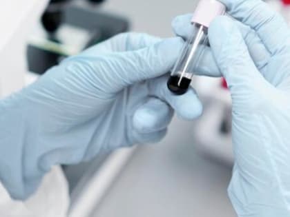 Почти 15 миллионов получит Вологодская область для регуляции уровня глюкозы