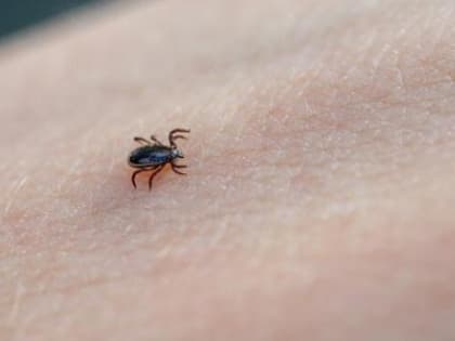 Инфекционист советует вологжанам пройти еще одну вакцинацию