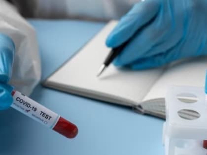 Минздрав предложил перейти к выборочной вакцинации от COVID-19