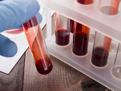 Новое оборудование для измерения уровня гемоглобина в крови получила Вологодская ЦРБ