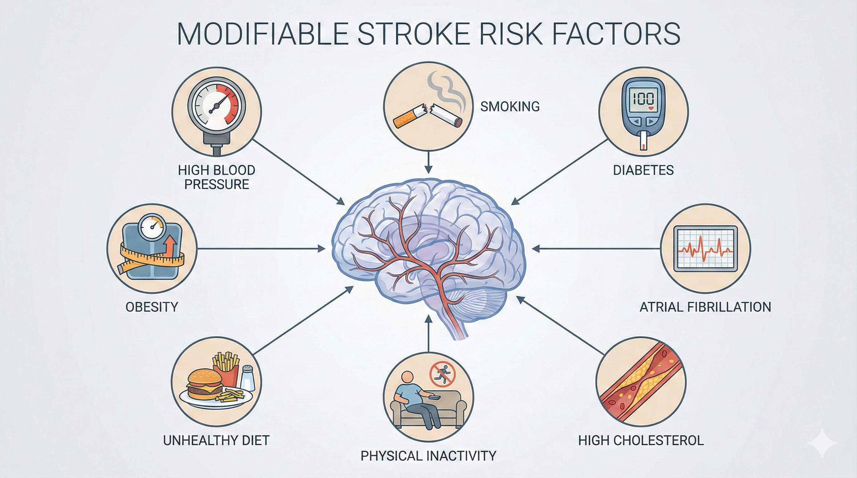 Infographic showing stroke risk factors like high blood pressure, smoking, and diabetes.