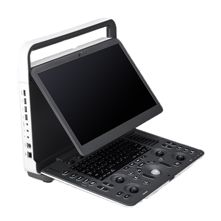 Sonoscape E1
