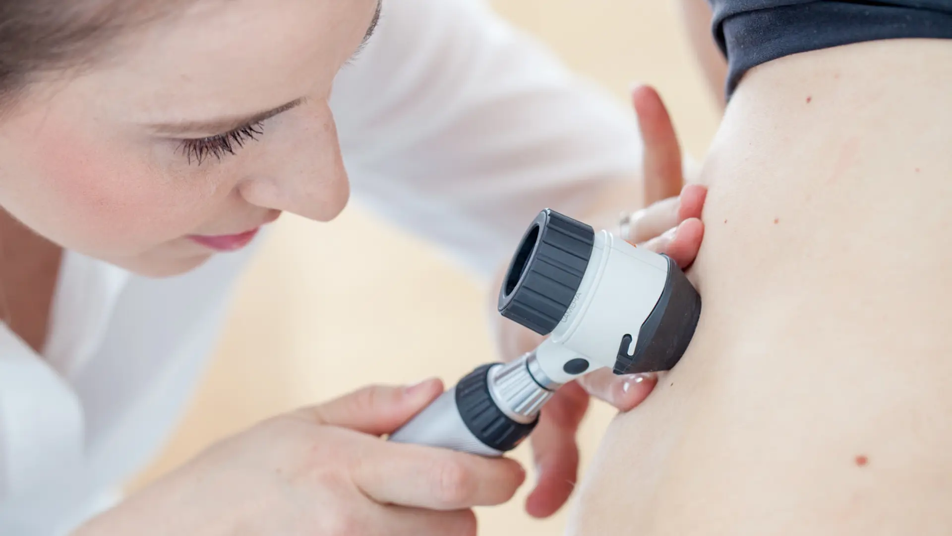 Combinación de vacuna personalizada y pembrolizumab reduce significativamente la recurrencia y mortalidad del melanoma