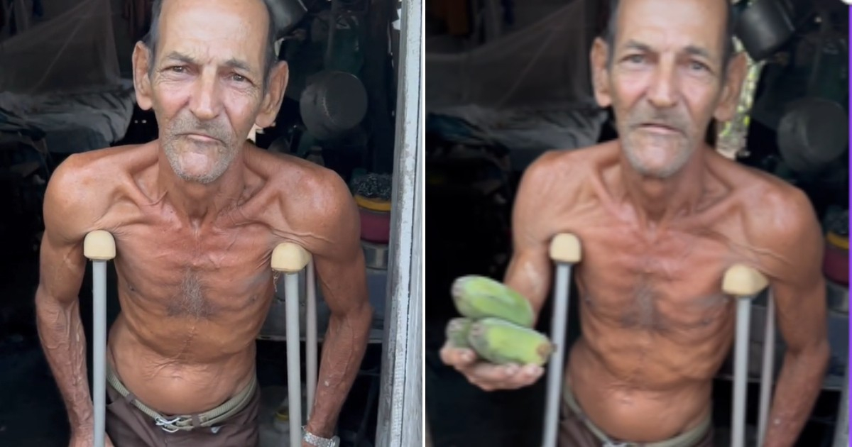 Un hombre cubano pide ayuda tras comer solo plátanos durante días