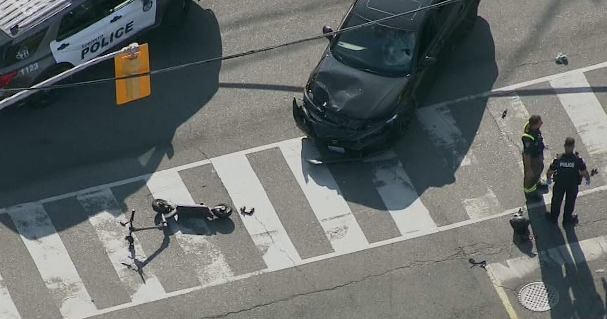 Toronto Man Injured in Scooter Accident After Being Struck by Vehicle