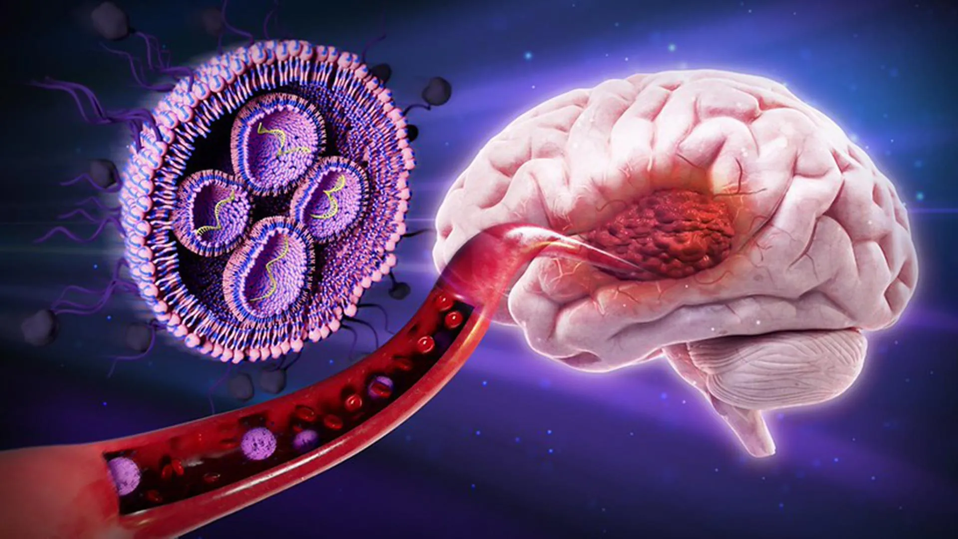 Sugar-Coated Nanoparticles Target Brain Tumors in Experimental Therapy