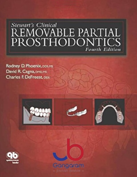 Removable partial prosthodontics