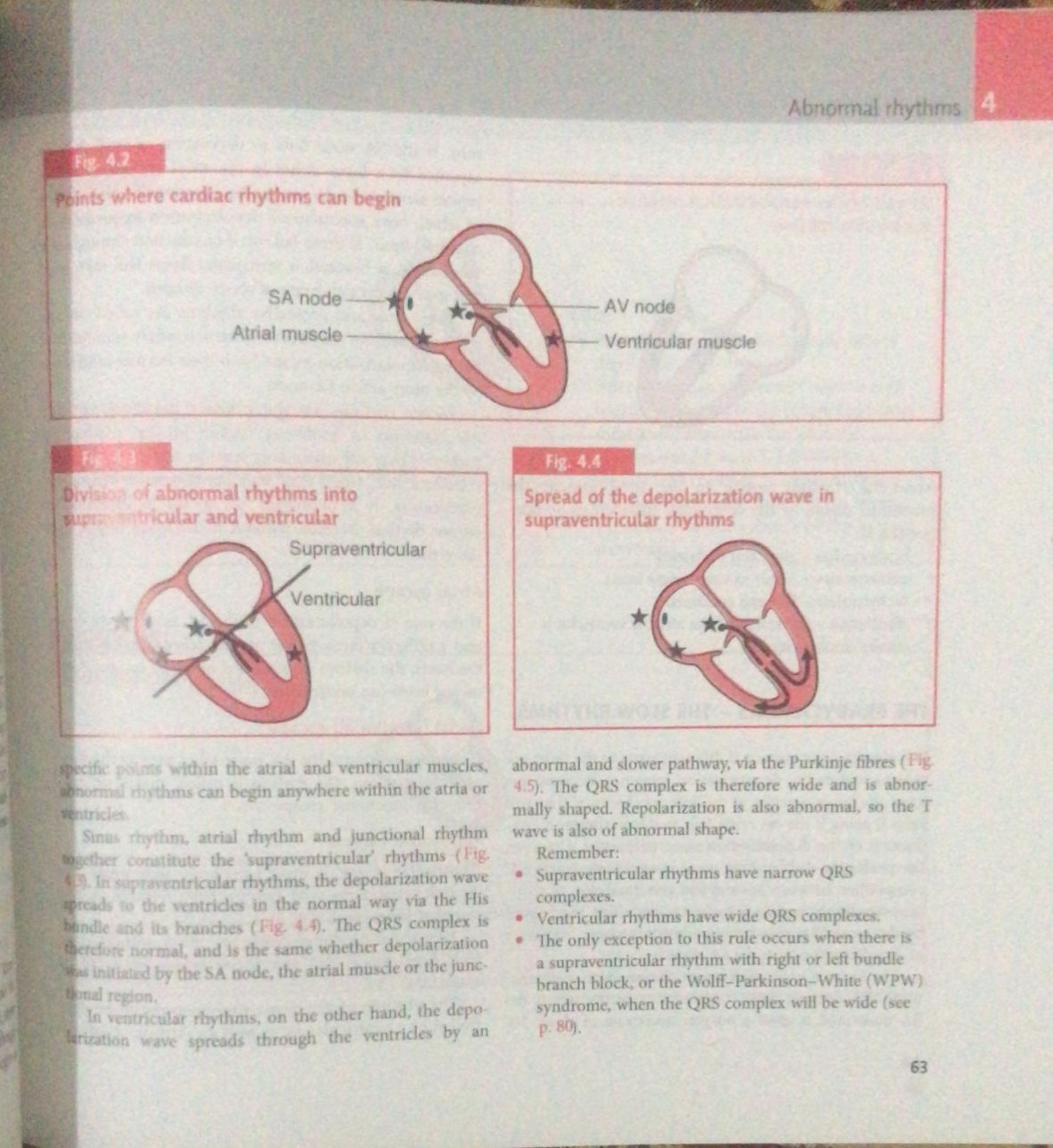 THE ECG MADE EASY| LATEST EDITION 2024-25 - Image 3