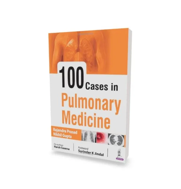 100 Cases in Pulmonary Medicine| Latest Edition - Image 2