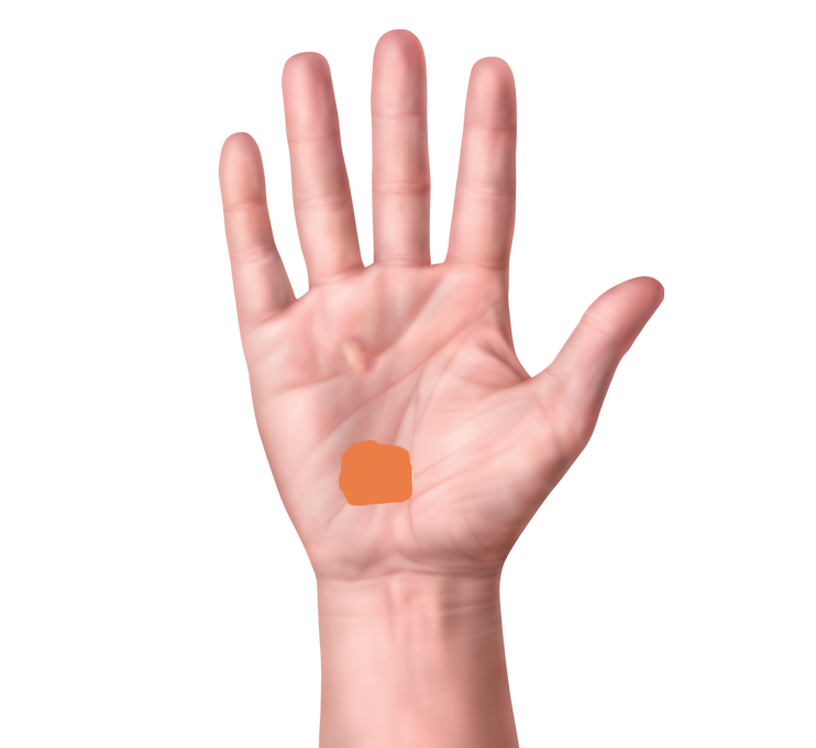 Pinkie side hand pain issues Talk Tennis