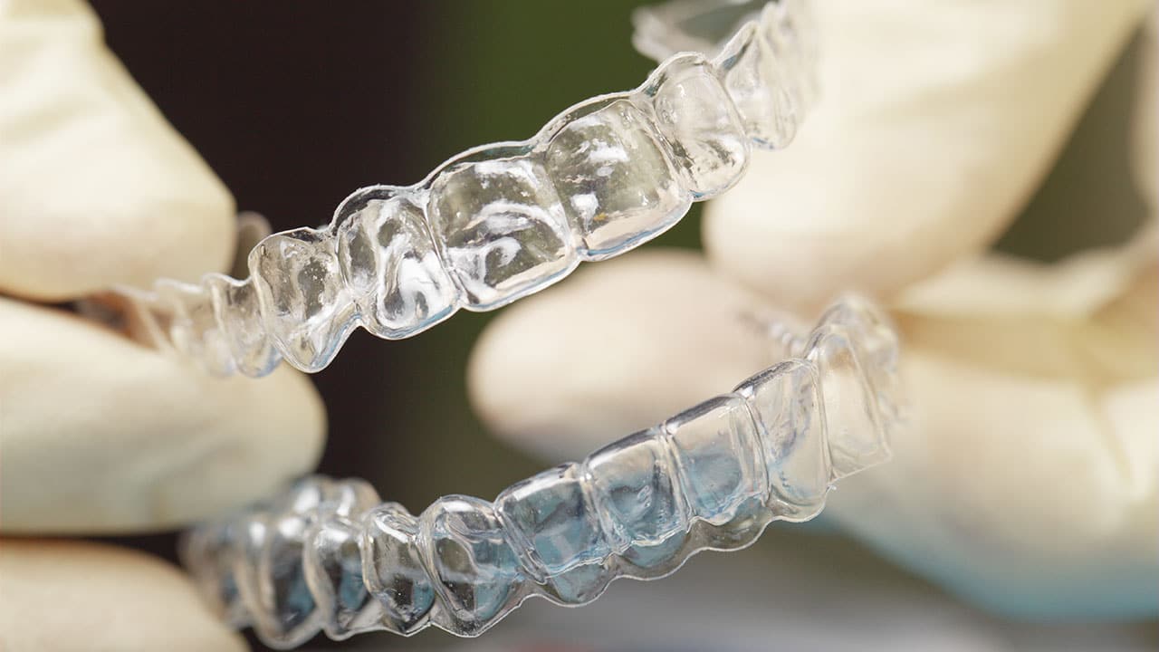 Clear orthodontic aligner trays held by a dental professional wearing gloves