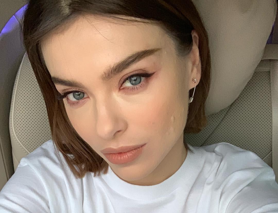 Щеки налились, как в 18 лет! Елене Темников удалили шрамы на лице с помощью жира с живота