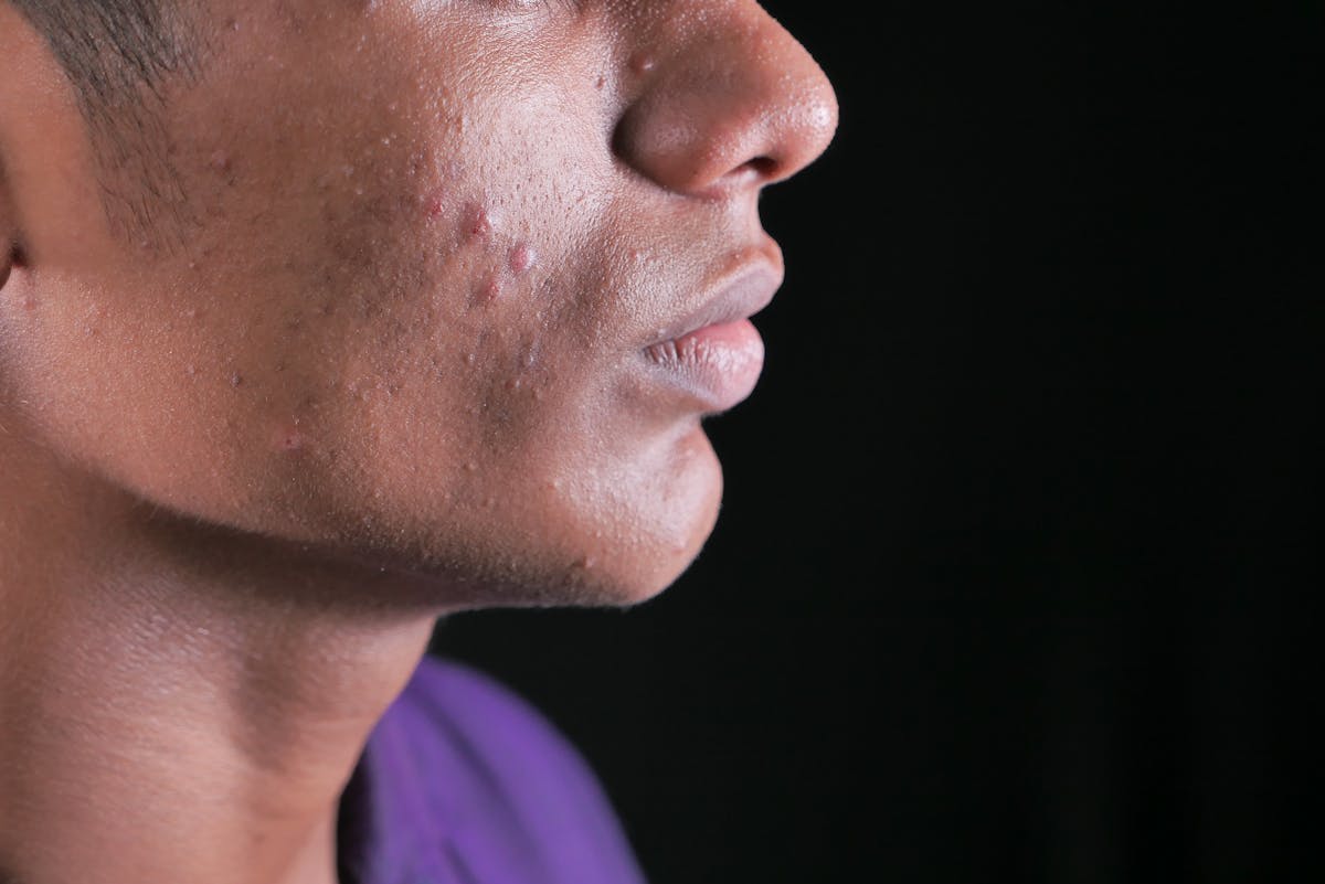 Skin Problems in Pakistan: AI Diagnosis Guide