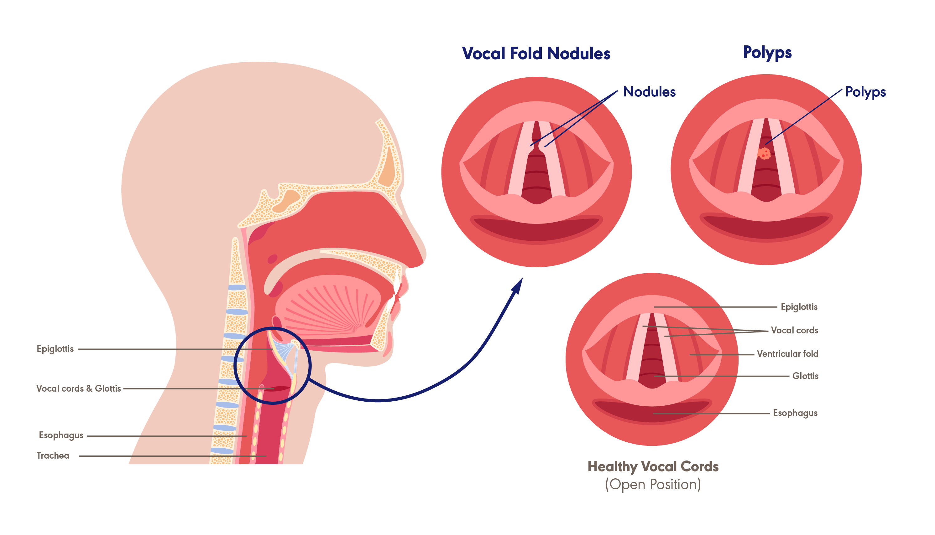 glutathione injection adverse effects Glutathione Injections: Benefits, Cost & Side Effects