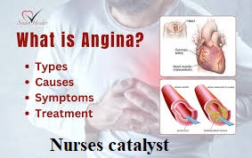 Understanding Angina: Symptoms, Management, and Care