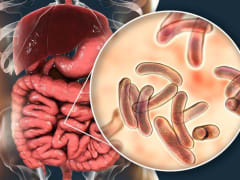 Холера и ее профилактика - памятка для населения