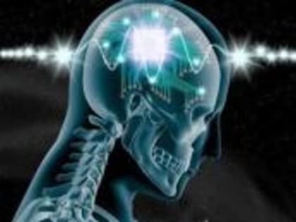 Новый мозговой имплантат помог повысить скорость мышления на 32%