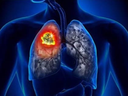 В Ингушетии началась Неделя профилактики инфекционных заболеваний (в честь Всемирного дня борьбы против туберкулёза)