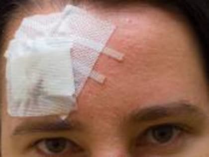 Жительница Ингушетии получила касательное ранение головы из-за неосторожности