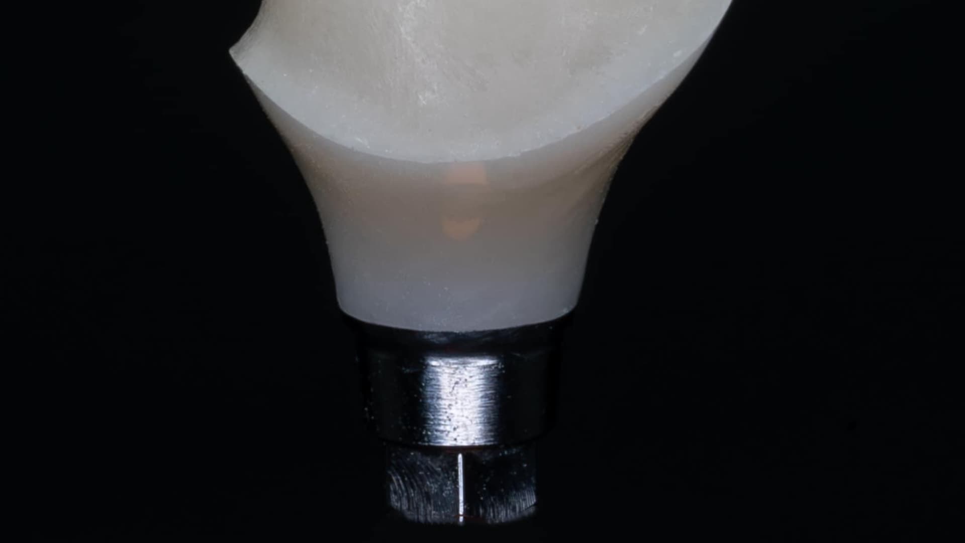 Intervento di implantologia computer guidata Torino - Studio Buniato