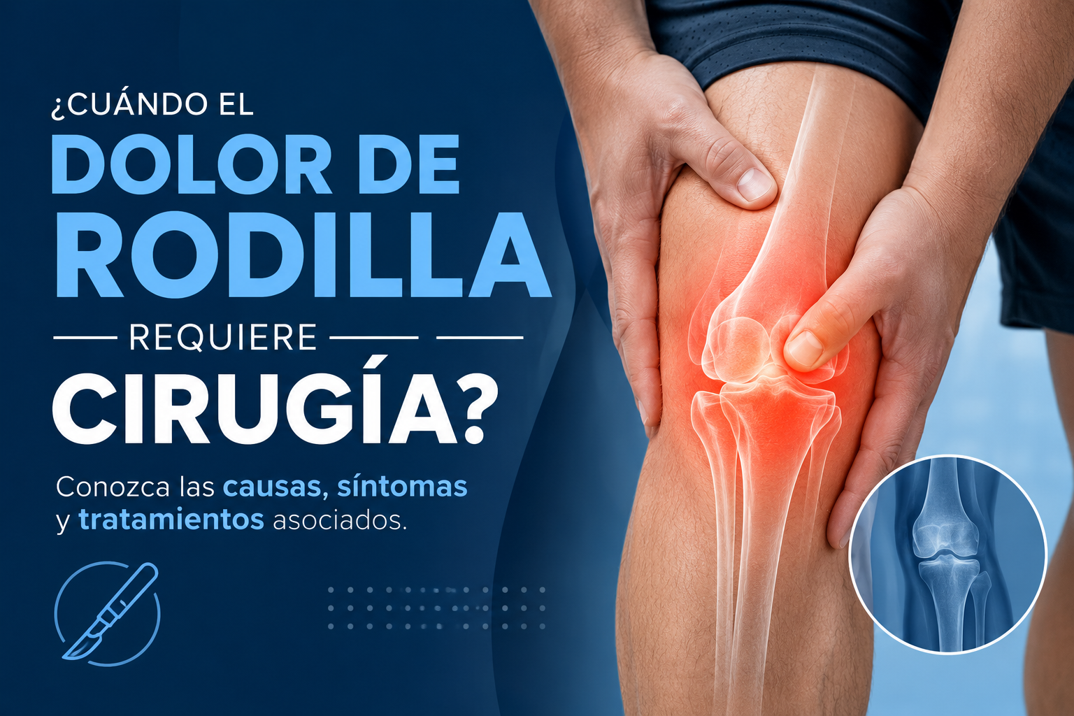 ¿Cuándo el dolor de rodilla requiere cirugía?