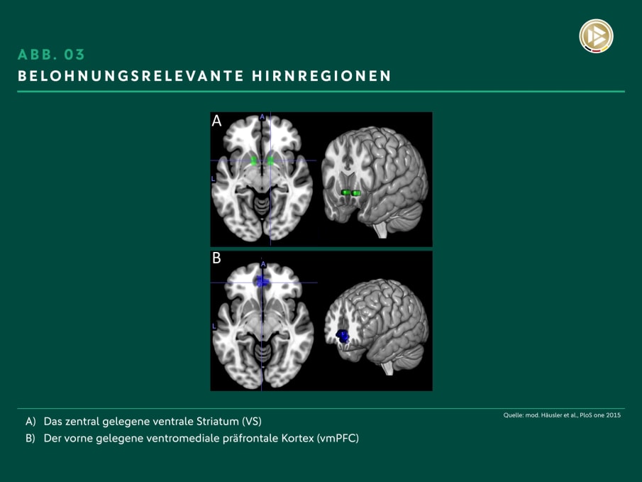 Abbildung 03: Belohnungsrelevante Hirnregionen Die belohnungsrelevanten Hirnregionen: das zentral gelegene Striatum (VS) und der vorne gelegene ventromediale präfrontale Kortex (vmPFC).