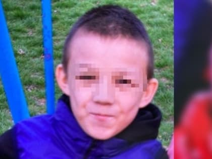«Снова убежал»: в Волжском разыскивают 13-летнего подростка со шрамом на лбу