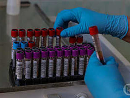 132 волгоградцев подкосил смертельно опасный вирус