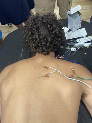 שגיא דטו image 4