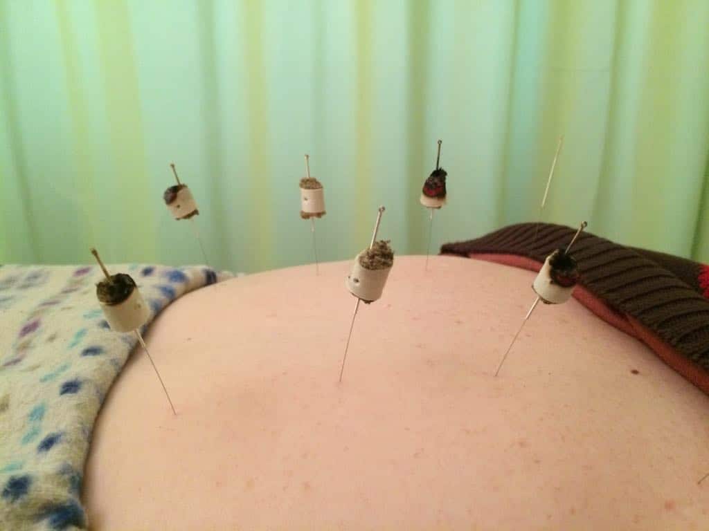 עידו לוי - מטפל ברפואה סינית image 2