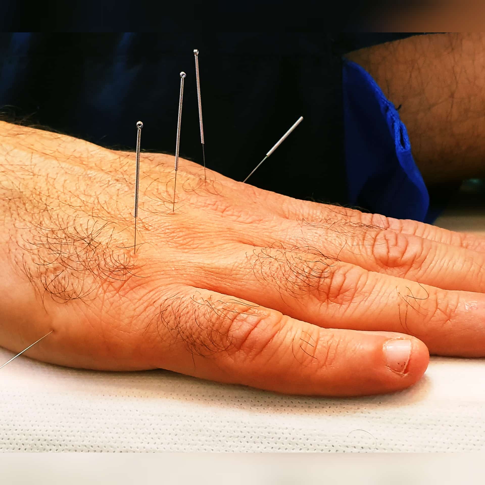 עידו לוי - מטפל ברפואה סינית image 4