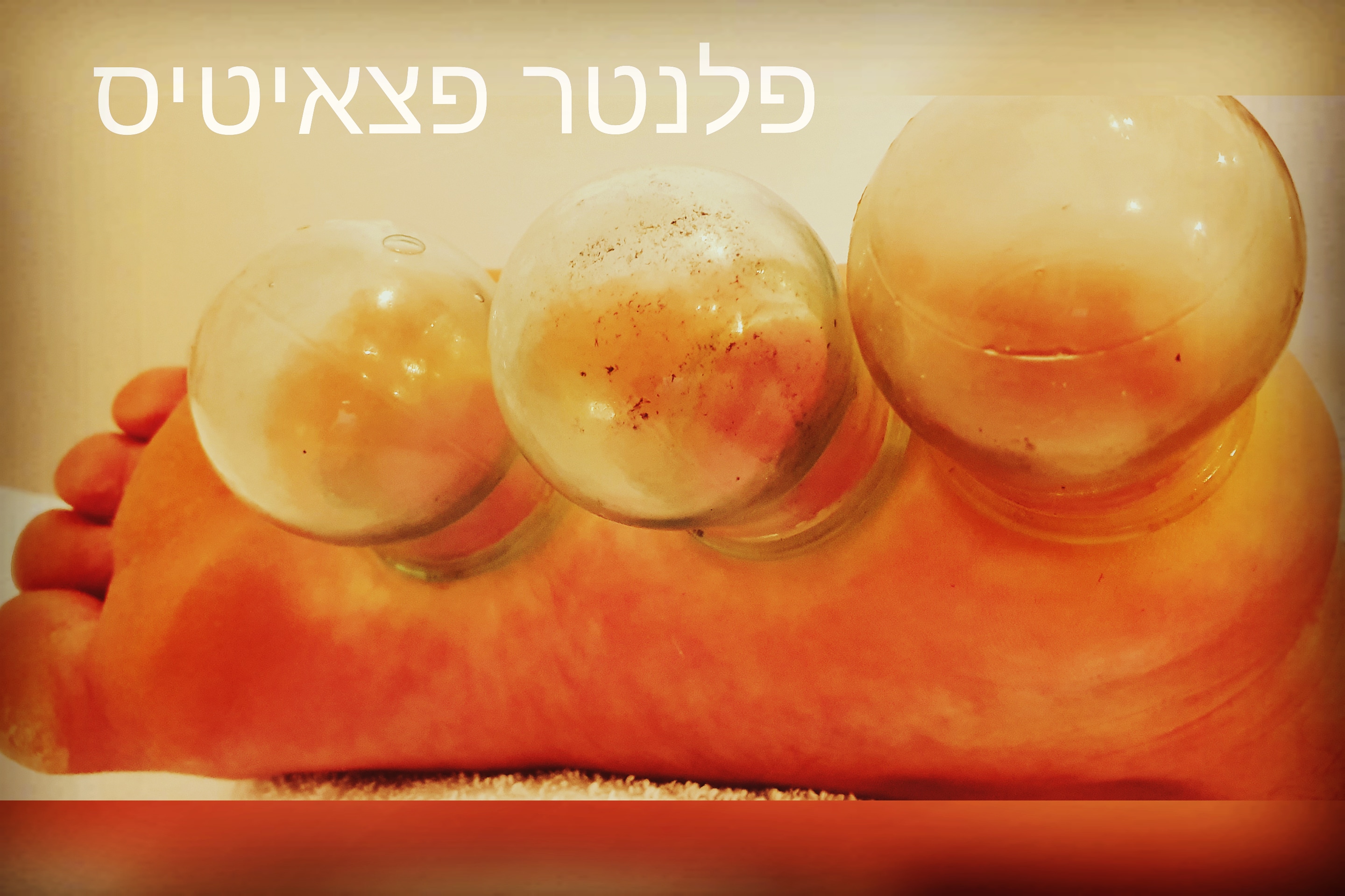 עידו לוי - מטפל ברפואה סינית image 5