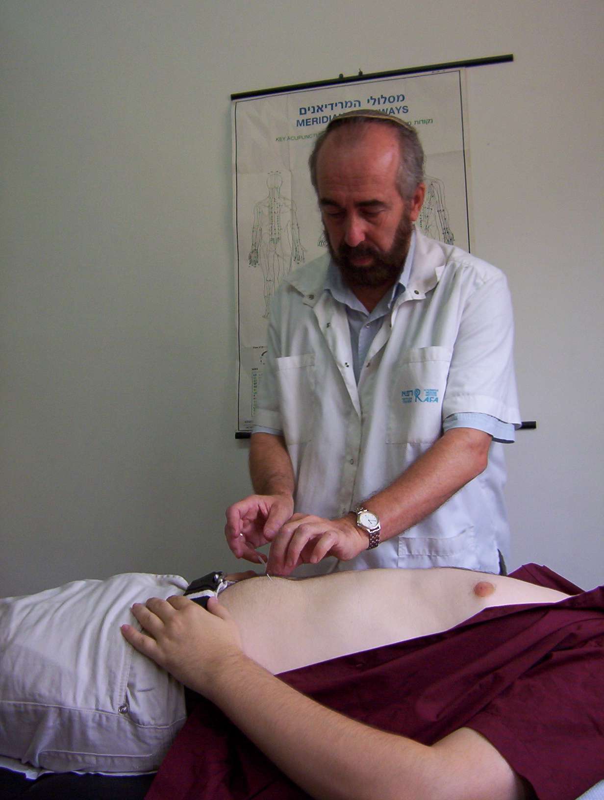 רפאל רוזנסקי מטפל בדיקור סיני image 2