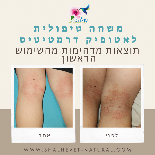 שלהבת נטורופתית ורוקחת טבעית image 5