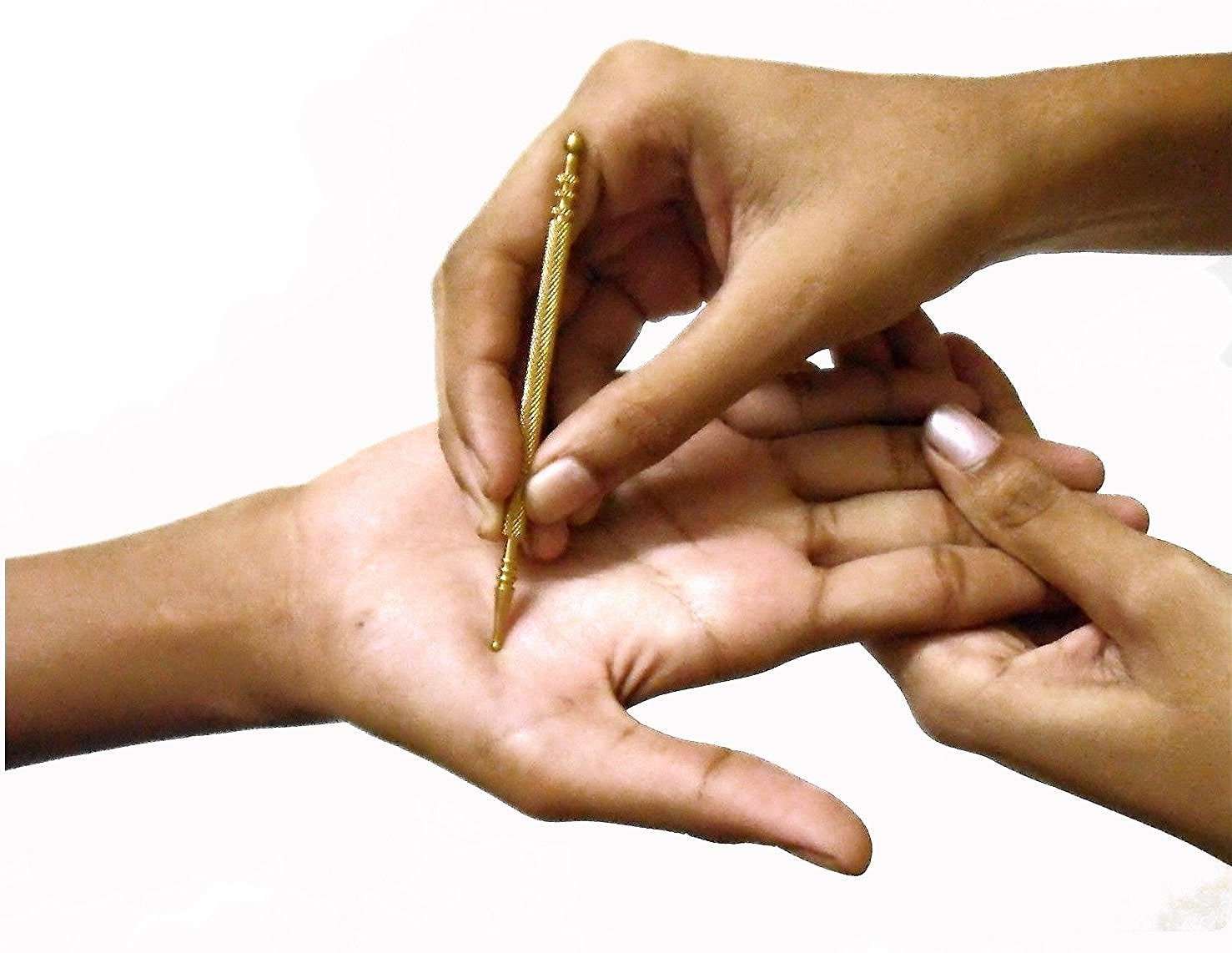 דרור כץ מטפל בשיטת הסו-ג'וק image 1